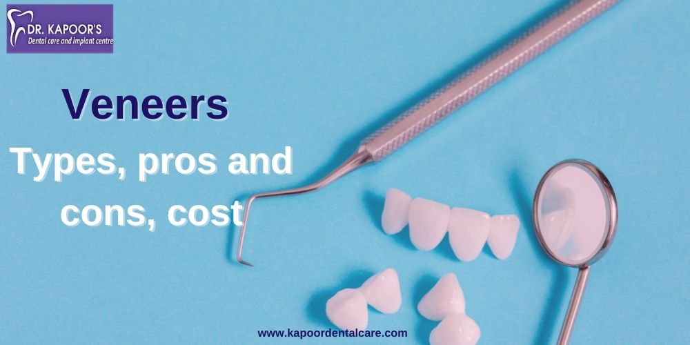 Veneers: Types, Pros And Cons, Cost - Dr Kapoor's Dental Care